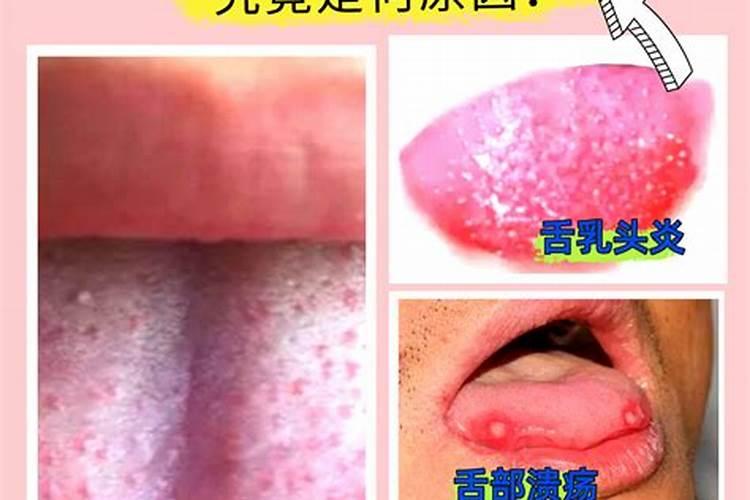 菜花怎样合理施肥？