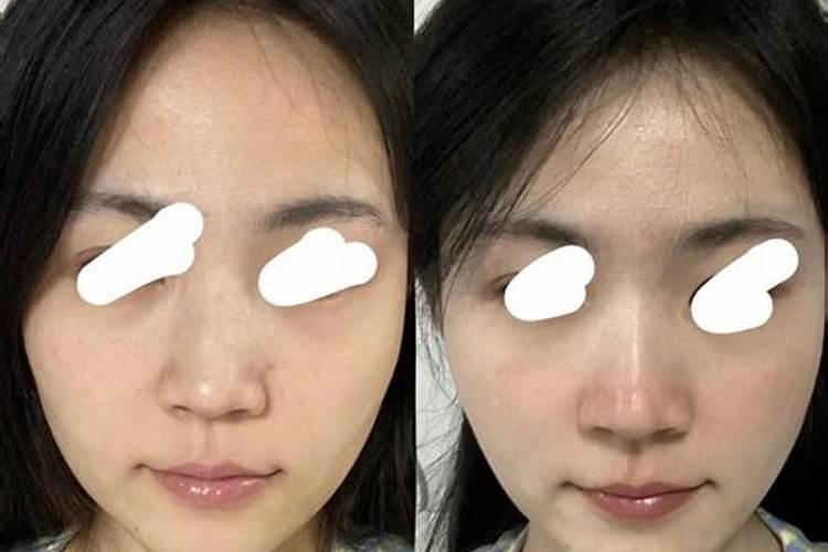 鱼蛋白对植物的作用