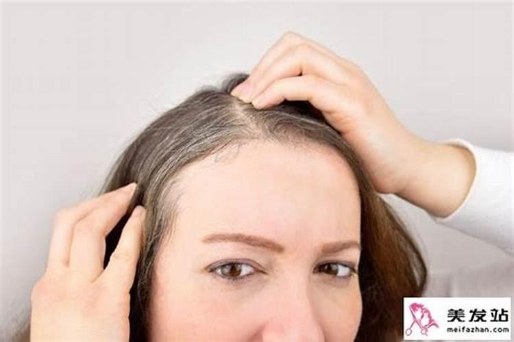 长白头发吃什么好